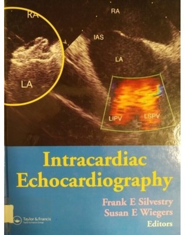 Intracardiac echocardiography - Silvestry Frank E., Wiegers Susan E.